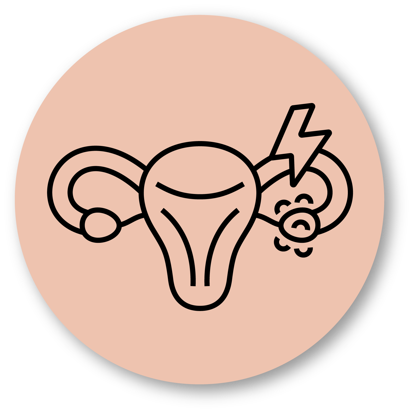 Polycystic Ovarian Syndrome (PCOS)